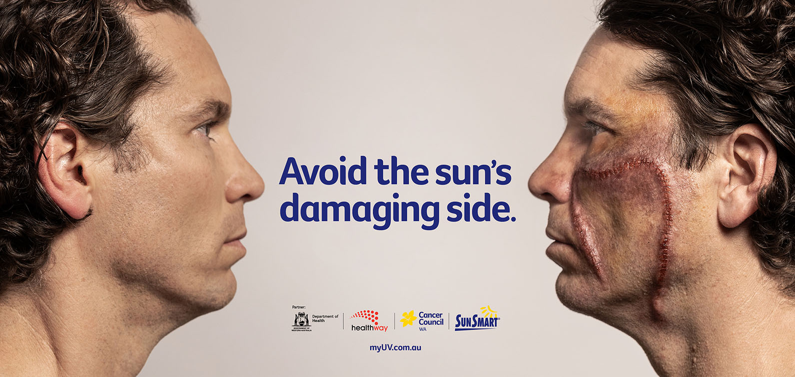Gatecrasher demonstrates the two sides of the sun via new awareness campaign for SunSmart