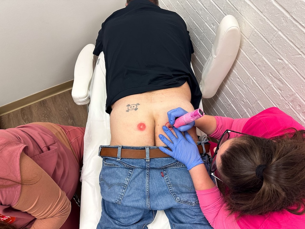 Seen+Noted: US breast cancer survivor clinic Perky launches ‘Third Nipple’ campaign to fight against social media censorship